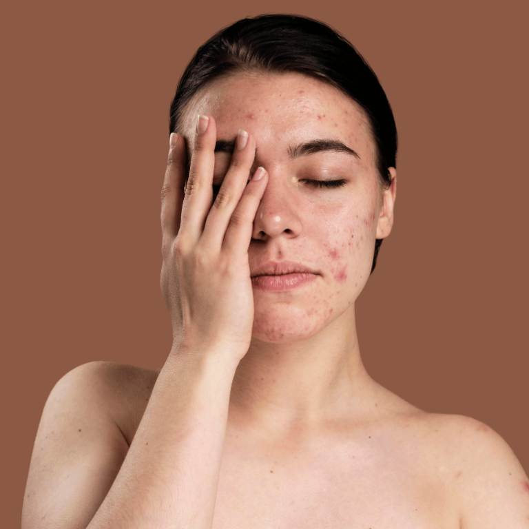 General Skin Issues