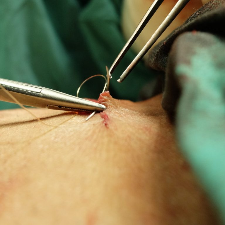 cropped-image-surgeon-stitching-patient-skin