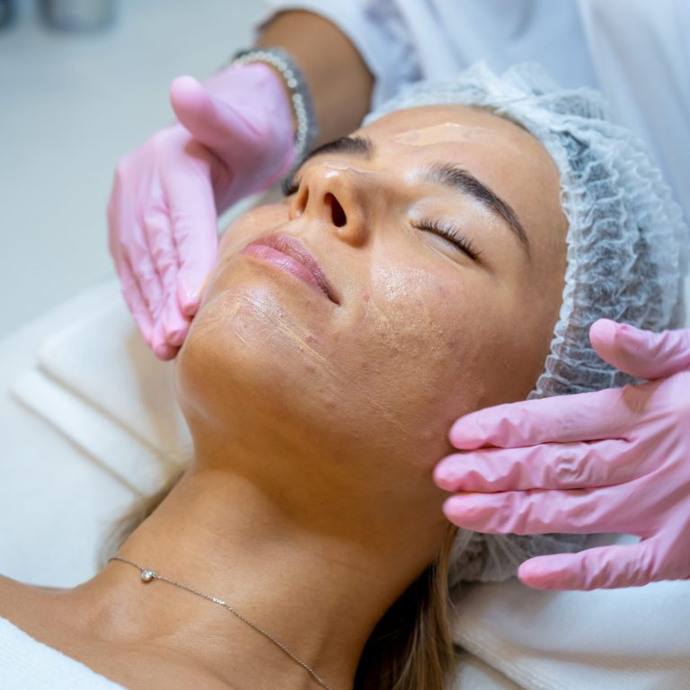 Female face getting microdermabrasion procedure in a beauty spa salon. Skin care treatment.